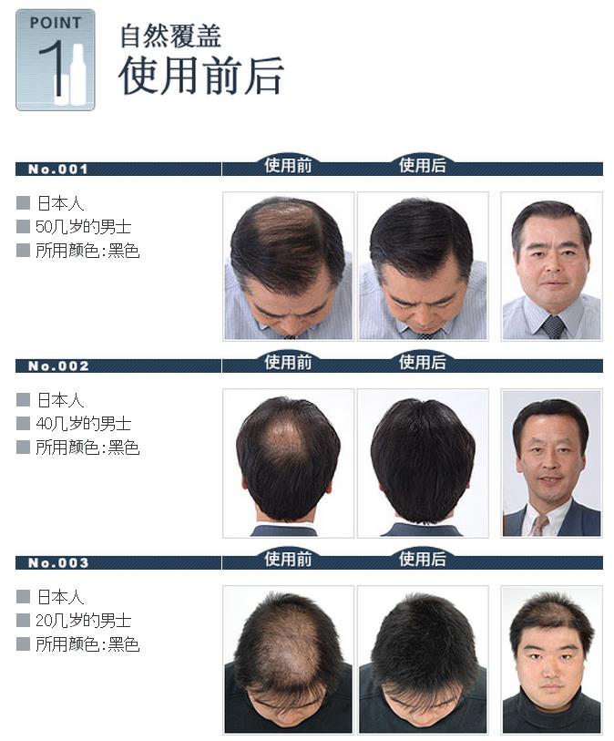 迷丽发 斑秃的对策 瞬间増毛   路绮（上海）贸易有限公司