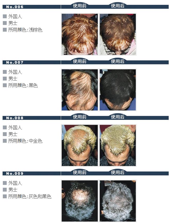 迷丽发 斑秃的对策 瞬间増毛   路绮（上海）贸易有限公司