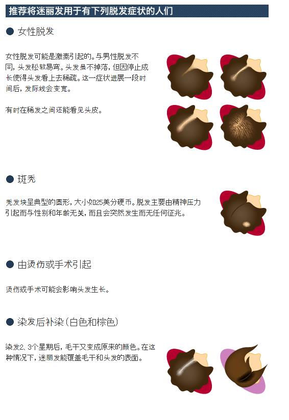 迷丽发 斑秃的对策 瞬间増毛   路绮（上海）贸易有限公司