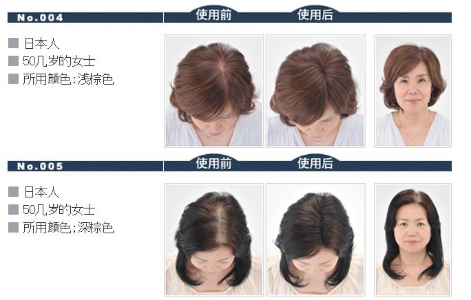 迷丽发 斑秃的对策 瞬间増毛   路绮（上海）贸易有限公司